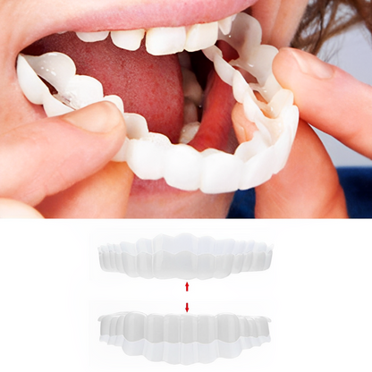 Smile Veneer (Upper & Lower Included)